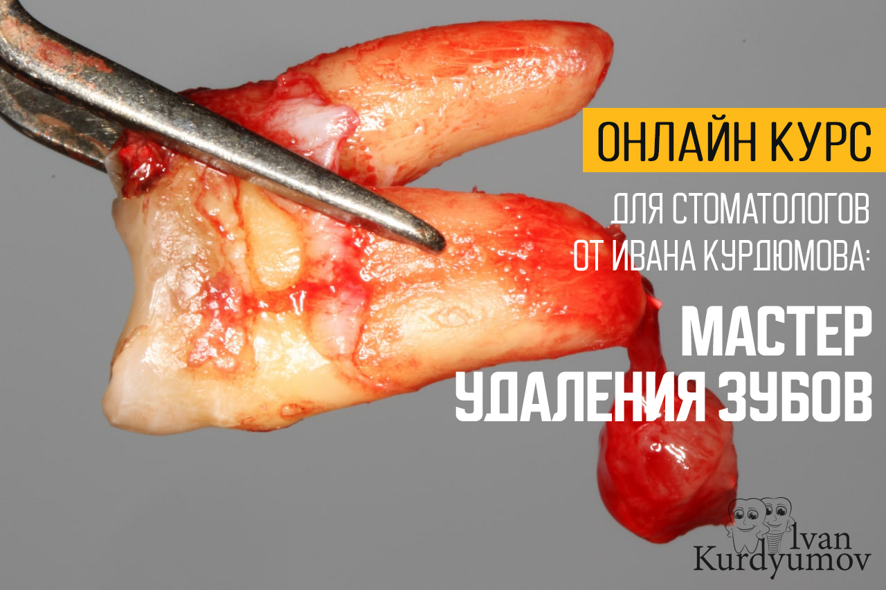 Онлайн курс Мастер удаления зубов от Учебный Центр Белая Медведица