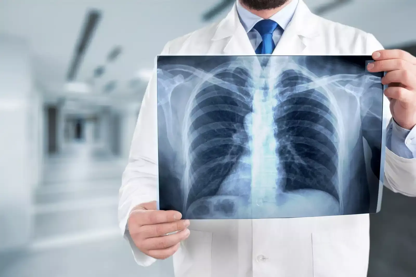 Онлайн курс Фтизиатрия от Единый Центр Обучения Онлайн курс Фтизиатрия от Единый Центр Обучения